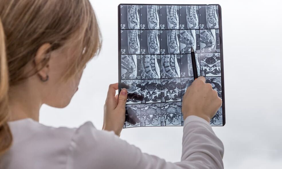 Magnetic resonance imaging will help the doctor identify osteochondrosis and prescribe treatment